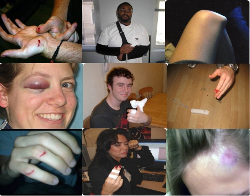 Wii Injuries