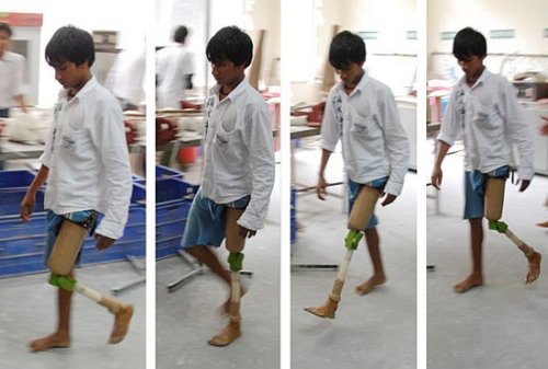 Stanford students create $20 prosthetic leg