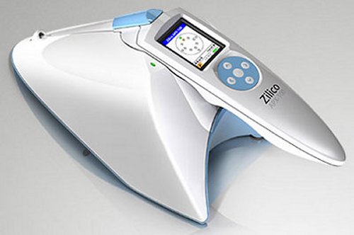 Zlico's System could be the end of Pap Smears