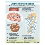 Cellphones may protect the brain from Alzheimer’s