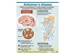 Cellphones may protect the brain from Alzheimer's
